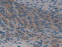 DAB staining on fromalin fixed paraffin-embedded Kidney tissue)