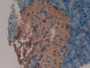 DAB staining on fromalin fixed paraffin-embedded Liver tissue)