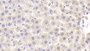 DAB staining on fromalin fixed paraffin-embedded Kidney tissue)