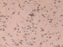 DAB staining on IHC-P; Samples: Mouse Brain Tissue; Primary Ab: 10µg/ml Rabbit Anti-Mouse MRP1 Antibody Second Ab: 2µg/mL HRP-Linked Caprine Anti-Rabbit IgG Polyclonal Antibody