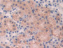 DAB staining on IHC-P; Samples: Mouse Kidney Tissue; Primary Ab: 10µg/ml Rabbit Anti-Mouse FUT4 Antibody Second Ab: 2µg/mL HRP-Linked Caprine Anti-Rabbit IgG Polyclonal Antibody
