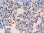 DAB staining on fromalin fixed paraffin-embedded Stomach tissue)