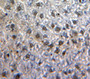 Used in DAB staining on fromalin fixed paraffin-embedded Liver tissue