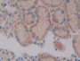 DAB staining on IHC-P; Samples: Rat Kidney Tissue; Primary Ab: 10µg/ml Rabbit Anti-Rat CYP7A1 Antibody Second Ab: 2µg/mL HRP-Linked Caprine Anti-Rabbit IgG Polyclonal Antibody