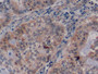 DABstainingonIHC-P.Samples:HumanTissue)