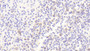 DAB staining on IHC-P; Samples: Human Spleen Tissue;  Primary Ab: 20μg/ml Rabbit Anti-Human TNFRSF7 Antibody Second Ab: 2µg/mL HRP-Linked Caprine Anti-Rabbit IgG Polyclonal Antibody 