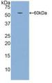 Western Blot; Sample: Recombinant ITGb1, Human.