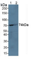 Western Blot; Sample: Lane1: Mouse Liver Tissue; Lane2: Rat Liver Tissue.