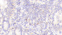DAB staining on IHC-P; Samples: Human Small intestine Tissue; Primary Ab: 20μg/ml Rabbit Anti-Human GHR Antibody Second Ab: 2µg/mL HRP-Linked Caprine Anti-Rabbit IgG Polyclonal Antibody
