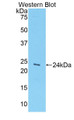 Western Blot; Sample: Recombinant protein.