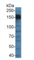 Western Blot; Sample: Human Jurkat cell lysate; Primary Ab: 5µg/ml Rabbit Anti-Mouse PTPRC Antibody Second Ab: 0.2µg/mL HRP-Linked Caprine Anti-Rabbit IgG Polyclonal Antibody