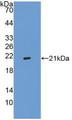 Western Blot; Sample: Recombinant ITGa2B, Human.