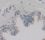 Integrin Alpha 2B (Itga2B) Polyclonal Antibody, Cat#CAU26639