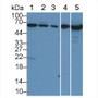 Albumin (ALB) Polyclonal Antibody, CAU26644