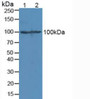 Western Blot; Sample: Lane1: Mouse Liver Tissue; Lane2: Mouse Brain Tissue.