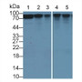 Western Blot; Sample: Lane1: Mouse Liver lysate; Lane2: Mouse Cerebrum lysate; Lane3: Mouse Heart lysate; Lane4: Porcine Cerebrum lysate; Lane5: Porcine Heart lysate; Primary Ab: 3µg/mL Rabbit Anti-Human CTNNb1 Ab; Second Ab: 0.2µg/mL HRP-Linked Caprine Anti-Rabbit IgG Polyclonal Antibody;