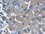 DAB staining on IHC-P; Samples: Human Liver Tissue; Primary Ab: 20µg/ml Rabbit Anti-Human CTNNb1 Antibody Second Ab: 2µg/mL HRP-Linked Caprine Anti-Rabbit IgG Polyclonal Antibody