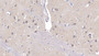 DAB staining on IHC-P; Samples: Human Cerebrum Tissue;  Primary Ab: 20µg/ml Rabbit Anti-Human APP Antibody Second Ab: 2µg/mL HRP-Linked Caprine Anti-Rabbit IgG Polyclonal Antibody 