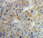 Used in DAB staining on fromalin fixed paraffin-embedded Liver tissue