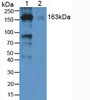 Western Blot; Sample: Lane1: Human Lung Tissue; Lane2: Human hepG2 Cells.