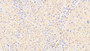 DAB staining on IHC-P; Samples: Human Liver Tissue; Primary Ab: 20μg/ml Rabbit Anti-Human a2M Antibody Second Ab: 2µg/mL HRP-Linked Caprine Anti-Rabbit IgG Polyclonal Antibody