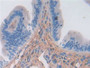 DAB staining on IHC-P; Samples: Mouse Uterus Tissue; Primary Ab: 30µg/ml Rabbit Anti-Mouse a1ACT Antibody Second Ab: 2µg/mL HRP-Linked Caprine Anti-Rabbit IgG Polyclonal Antibody