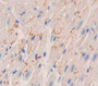 Placental Cadherin (P-Cadherin) Polyclonal Antibody, Cat#CAU26685