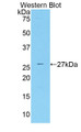 Western Blot; Sample: Recombinant protein.