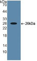 Western Blot; Sample: Recombinant RUNX2, Human.