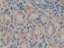 DAB staining on IHC-P; Samples: Human Stomach Tissue; Primary Ab: 10µg/ml Rabbit Anti-Human VLDLR Antibody Second Ab: 2µg/mL HRP-Linked Caprine Anti-Rabbit IgG Polyclonal Antibody