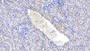 DAB staining on IHC-P; Samples: Human Kidney Tissue;  Primary Ab: 20μg/ml Rabbit Anti-Human GPC4 Antibody Second Ab: 2µg/mL HRP-Linked Caprine Anti-Rabbit IgG Polyclonal Antibody 