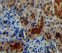 DAB staining on fromalin fixed paraffin-embedded kidney tissue)