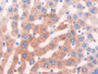 DAB staining on IHC-P; Samples: Rat Liver Tissue; Primary Ab: 30µg/ml Rabbit Anti-Rat CYP2E1 Antibody Second Ab: 2µg/mL HRP-Linked Caprine Anti-Rabbit IgG Polyclonal Antibody