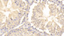 DAB staining on fromalin fixed paraffin-embedded Kidney tissue)