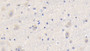 DAB staining on IHC-P; Samples: Human Cerebrum Tissue; Primary Ab: 20μg/ml Rabbit Anti-Human CYPA Antibody Second Ab: 2µg/mL HRP-Linked Caprine Anti-Rabbit IgG Polyclonal Antibody