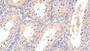 DAB staining on IHC-P; Samples: Bovine Testis Tissue; Primary Ab: 20µg/ml Rabbit Anti-Bovine CYPA Antibody Second Ab: 2µg/mL HRP-Linked Caprine Anti-Rabbit IgG Polyclonal Antibody