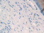 DAB staining on IHC-P; Samples: Mouse Esophagus Tissue; Primary Ab: 30µg/ml Rabbit Anti-Mouse GPC3 Antibody Second Ab: 2µg/mL HRP-Linked Caprine Anti-Rabbit IgG Polyclonal Antibody