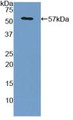 Glypican 3 (GPC3) Polyclonal Antibody, CAU26743