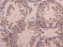 DAB staining on IHC-P; Samples: Mouse Testis Tissue; Primary Ab: 20µg/ml Rabbit Anti-Mouse ACVR1 Antibody Second Ab: 2µg/mL HRP-Linked Caprine Anti-Rabbit IgG Polyclonal Antibody