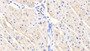 DAB staining on IHC-P; Samples: Human Cardiac Muscle Tissue;  Primary Ab: 20μg/ml Rabbit Anti-Human ACVR1 Antibody Second Ab: 2µg/mL HRP-Linked Caprine Anti-Rabbit IgG Polyclonal Antibody 