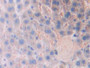 DAB staining on fromalin fixed paraffin- embedded kidney tissue)