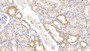 DAB staining on IHC-P; Samples: Human Kidney Tissue; Primary Ab: 20µg/ml Rabbit Anti-Human KLK1 Antibody Second Ab: 2µg/mL HRP-Linked Caprine Anti-Rabbit IgG Polyclonal Antibody