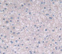 Atp Binding Cassette Transporter G2 (Abcg2) Polyclonal Antibody, Cat#CAU26758