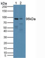 Western Blot; Sample: Lane1: Human Blood Cells; Lane2: Rat Brain Tissue.