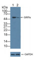 Knockout Varification: ; Lane 1: Wild-type 293T cell lysate; ; Lane 2: SIRPa knockout 293T cell lysate; ; Predicted MW: 55kd ; Observed MW: 55kd; Primary Ab: 2µg/ml Rabbit Anti-Human SIRPa Antibody; Second Ab: 0.2µg/mL HRP-Linked Caprine Anti-Rabbit IgG Polyclonal Antibody;