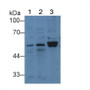 Western Blot; Sample: Lane1: Hela cell; Lane2: MCF7 cell; Lane3: Human Lung lysate; Primary Ab: 2µg/mL Rabbit Anti-Human TP Antibody; Second Ab: 0.2µg/mL HRP-Linked Caprine Anti-Rabbit IgG Polyclonal Antibody;