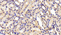 DAB staining on IHC-P; Samples: Rat Kidney Tissue; Primary Ab: 10μg/ml Rabbit Anti-Rat CHEM Antibody Second Ab: 2µg/mL HRP-Linked Caprine Anti-Rabbit IgG Polyclonal Antibody