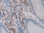 DAB staining on IHC-P; Samples: Human Stomach Tissue; Primary Ab: 30µg/ml Rabbit Anti-Human CHEM Antibody Second Ab: 2µg/mL HRP-Linked Caprine Anti-Rabbit IgG Polyclonal Antibody
