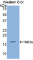 Western Blot; Sample: Recombinant protein.