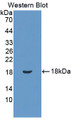 Western Blot; Sample: Recombinant protein.